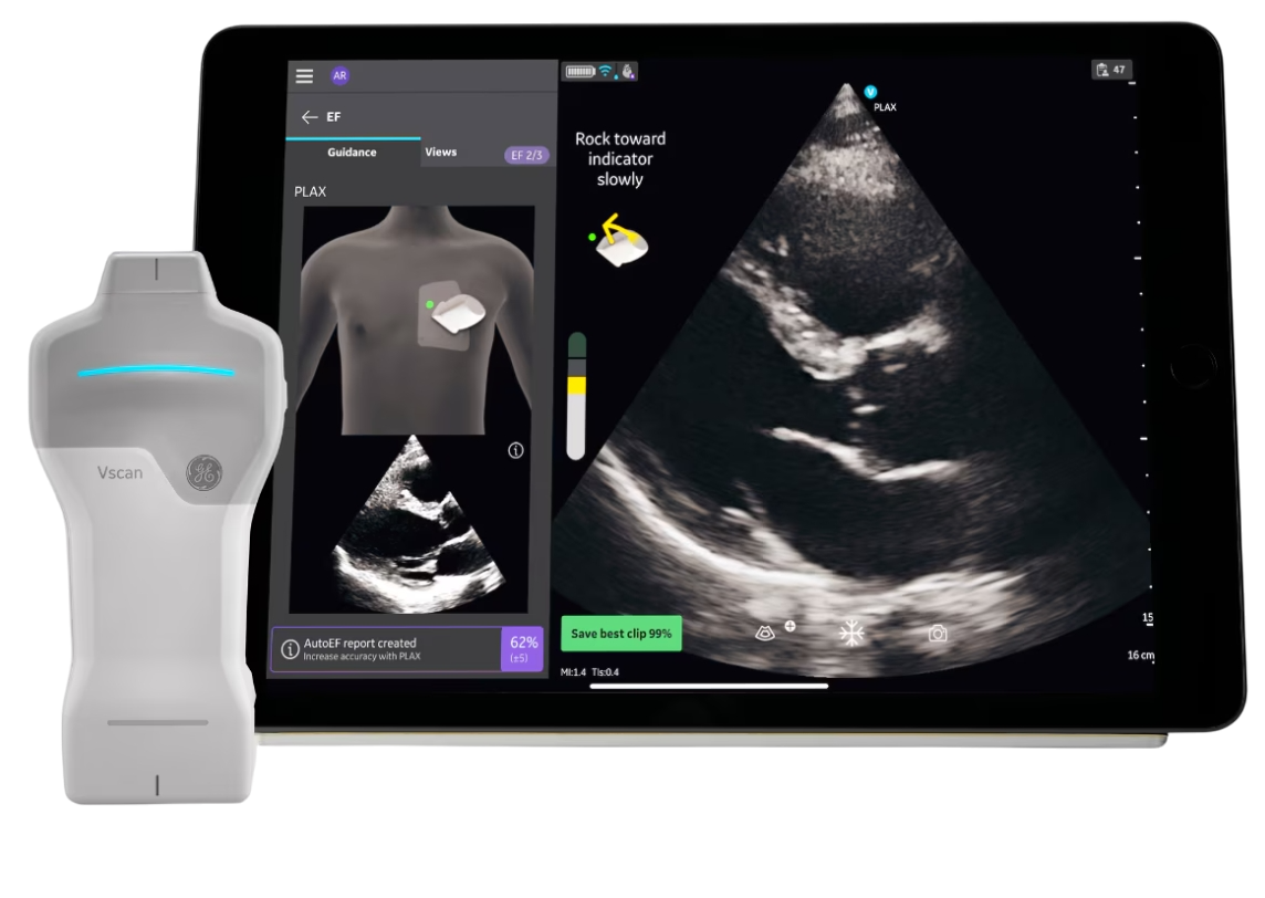 GE Vscan Air SL sector and linear dual-probe handheld ultrasound