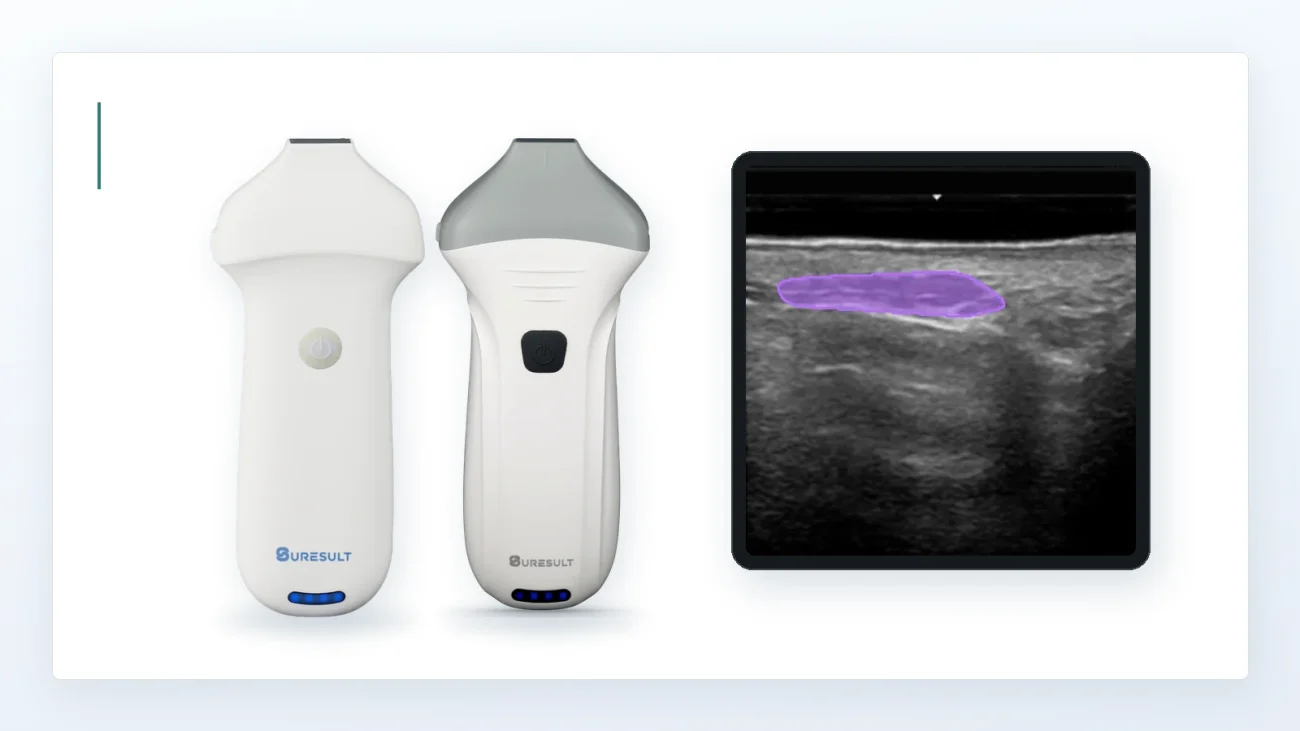 Kabellose Linear-Ultraschallsonden Suresult L24 und L24Pro neben einem FaceAtlas AI Filler Scan-Frame