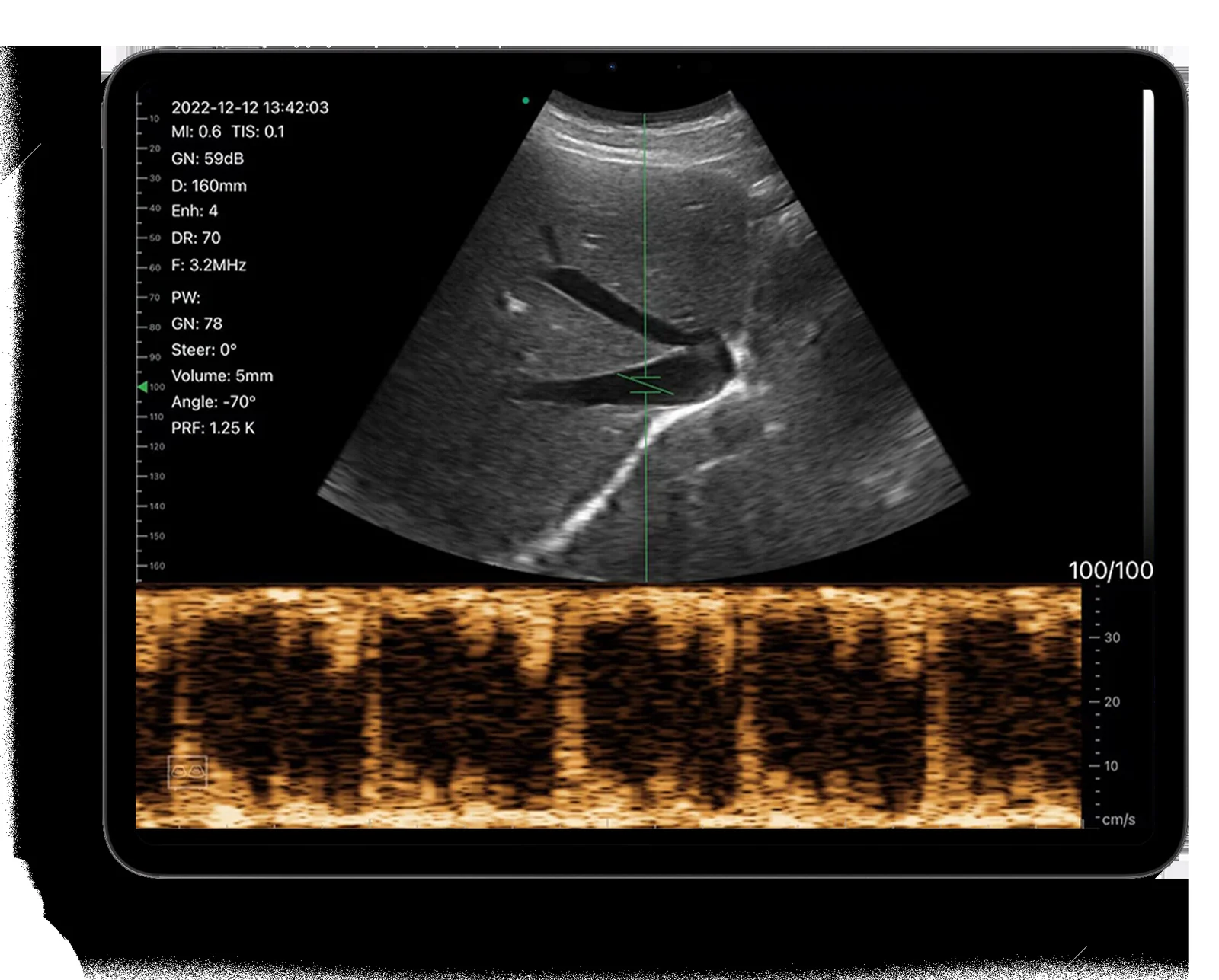 Pulsed wave Doppler on the convex head