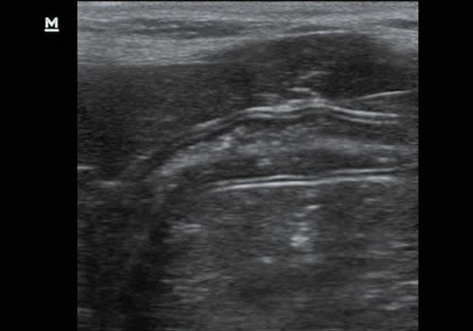 Echografie van hondendarm op Mindray Z60 Vet, van Mindray Animal Medical