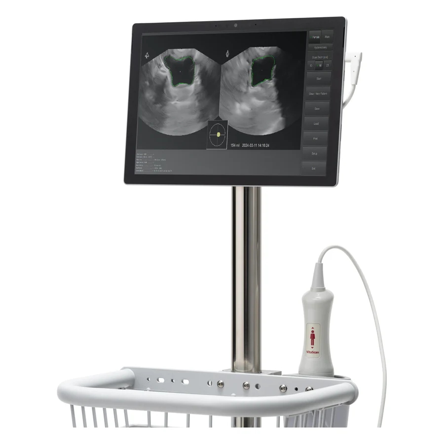 Vitacon Vitascan LT bladder scanner probe with its Windows tablet