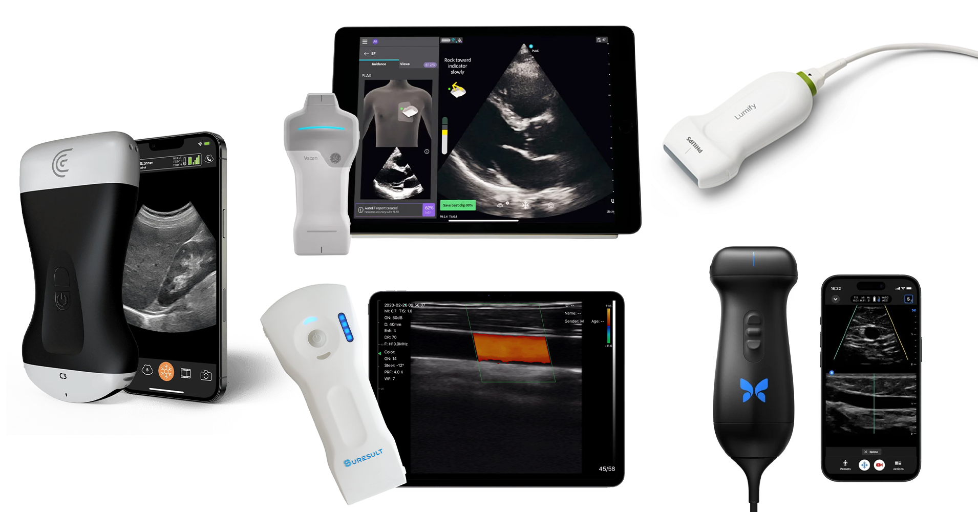 which handheld ultrasound is the most accurate in 2025
